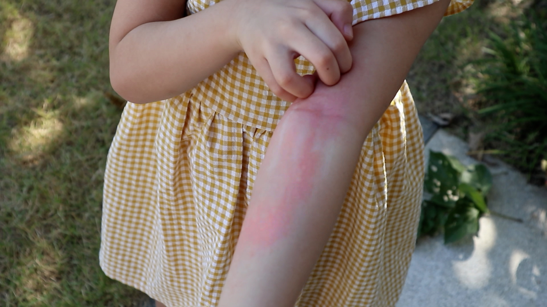 Preview image of 'Skin Conditions: Cradle Cap, Fungal Diaper Rash, Eczema, and More'