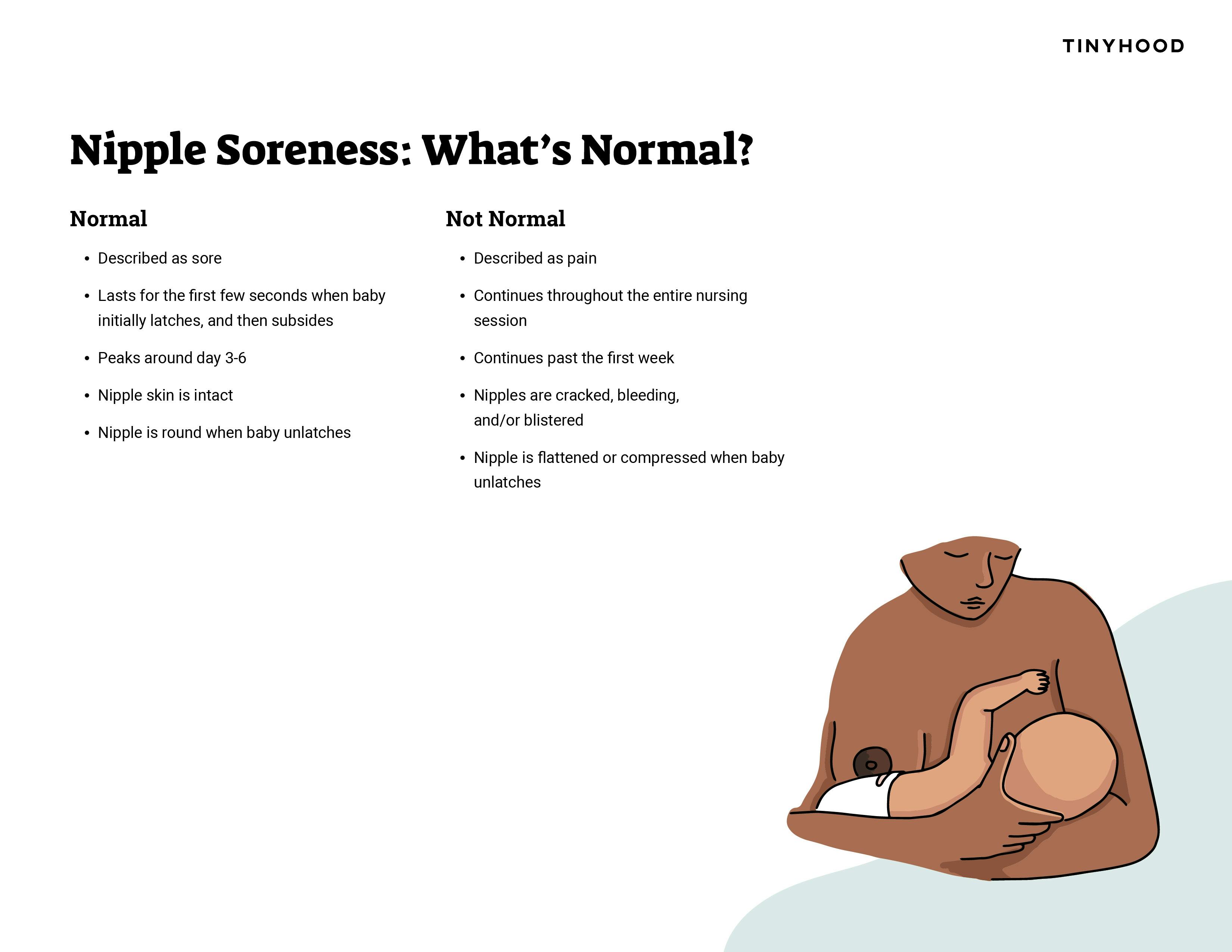 Preview image of Handout: Nipple Soreness: What's Normal?
