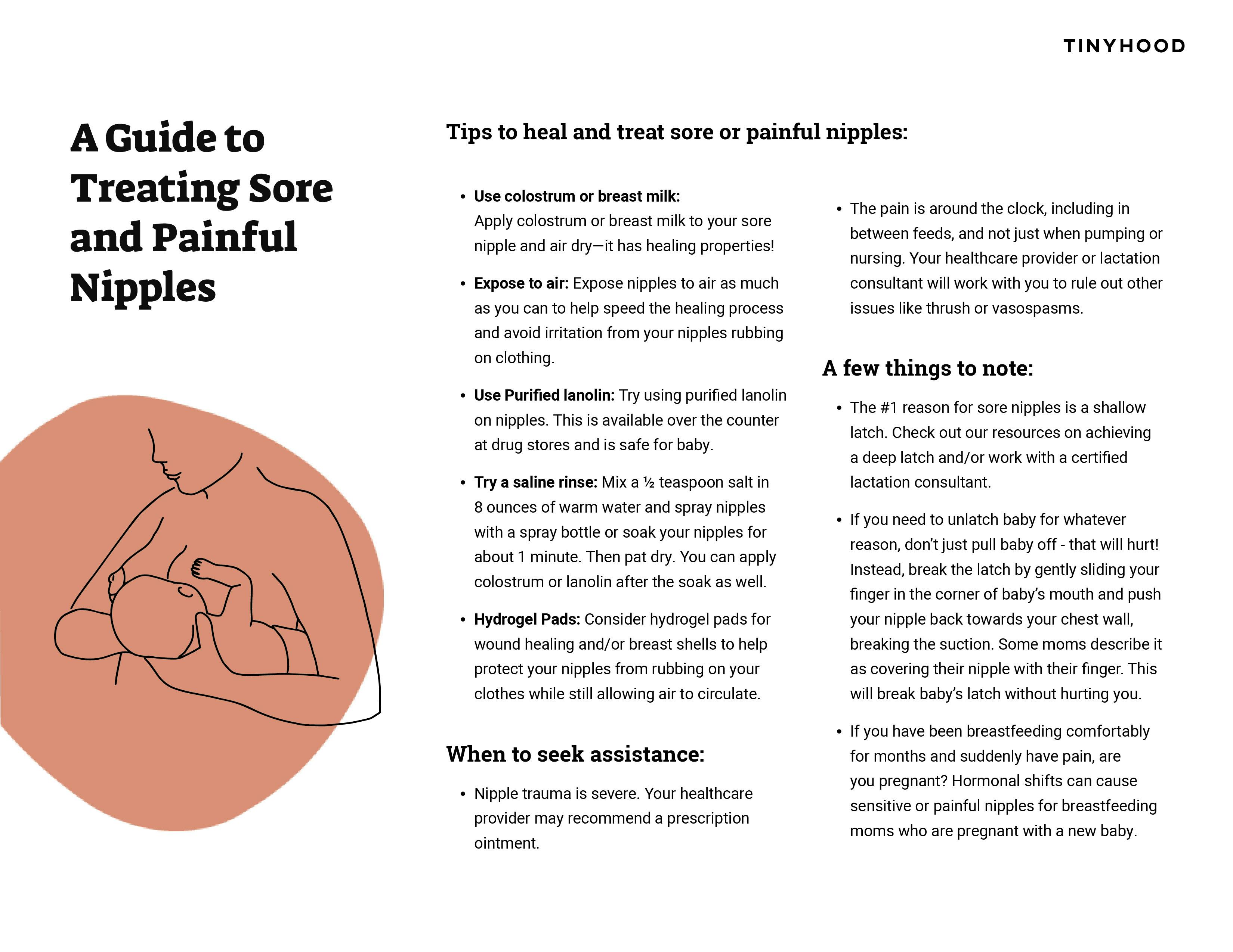 Preview image of Handout: Treating Sore Nipples